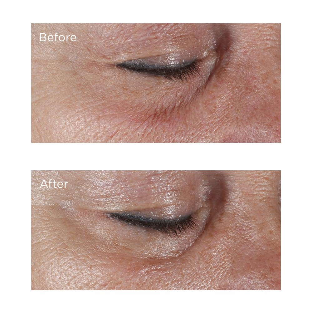 Perricone MD eye-cream in-use image demonstrates brightening and hydration in real routines.