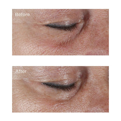 Perricone MD eye-cream in-use image demonstrates brightening and hydration in real routines.