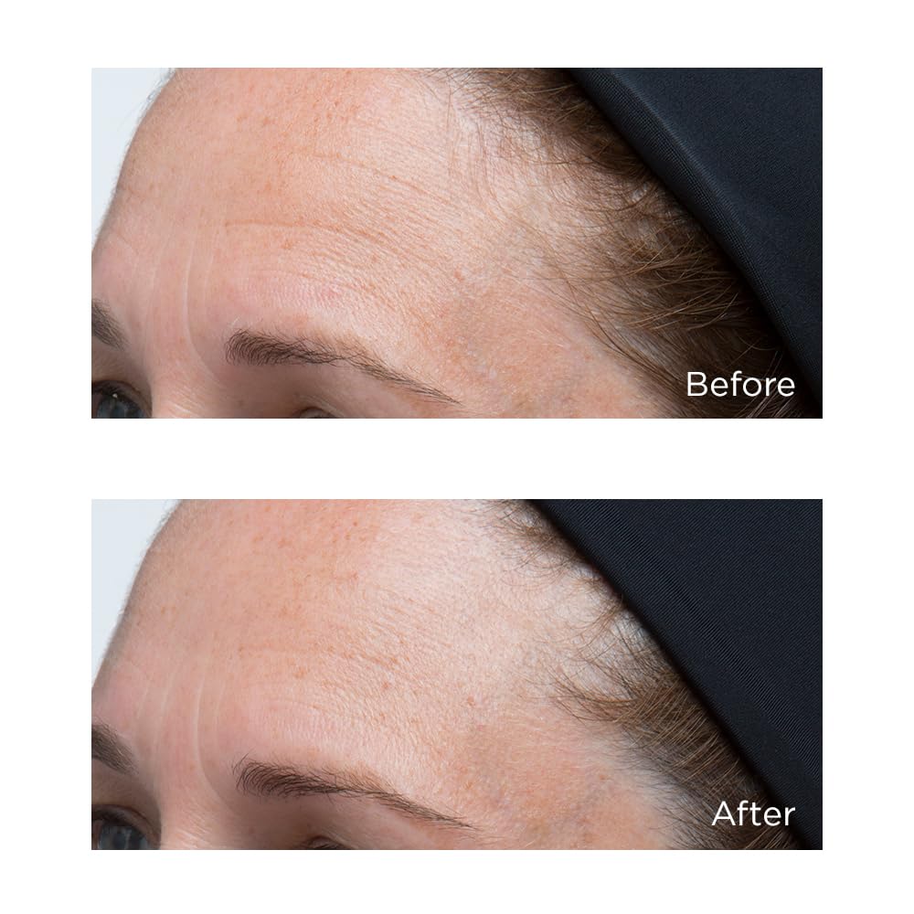 Perricone MD Hyaluronic Intensive Moisturizer on radiant skin suggests a healthy glow.