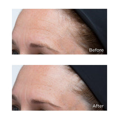 Perricone MD Hyaluronic Intensive Moisturizer on radiant skin suggests a healthy glow.