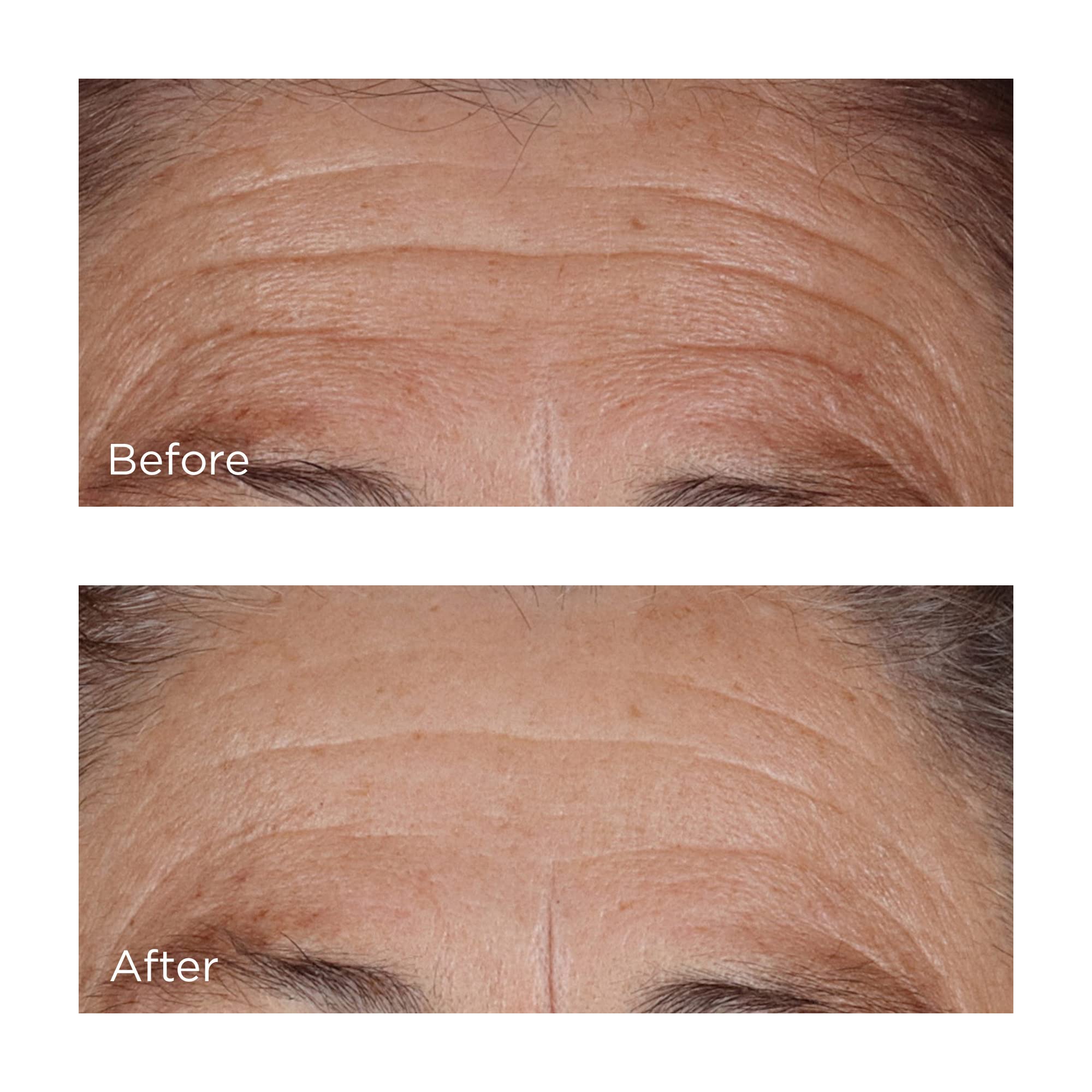 Perricone MD hyaluronic serum absorption image emphasizes quick settling into skin.