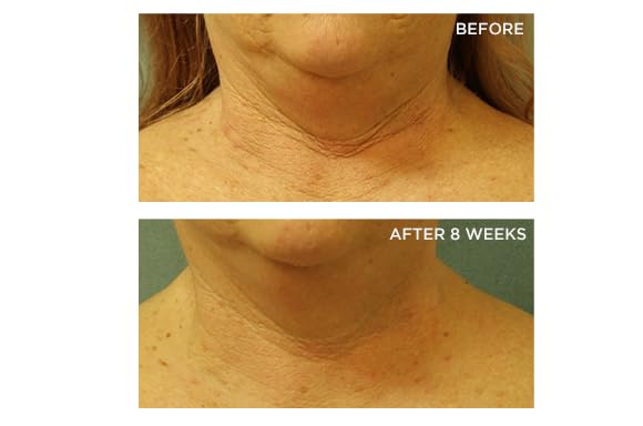 Perricone MD Neck-Chest SPF25 application swirl highlighting even tone
