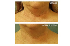 Perricone MD Neck-Chest SPF25 application swirl highlighting even tone