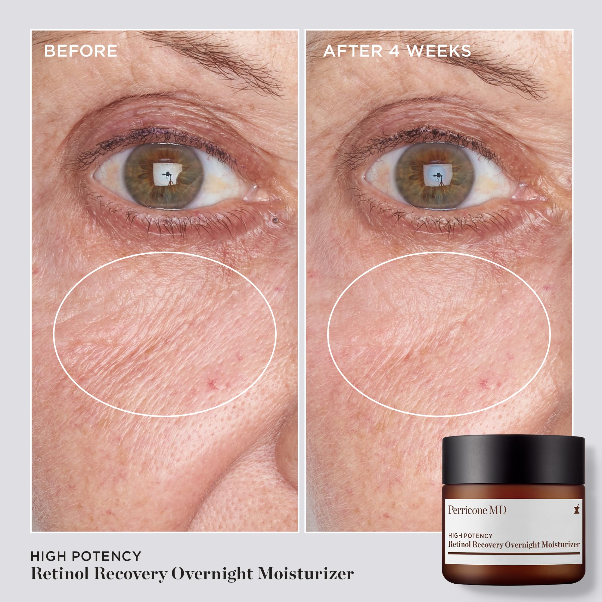 Perricone MD rich texture swatch showing luxurious overnight application and absorption.