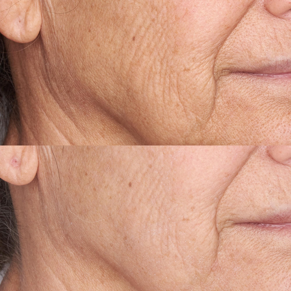 Perricone MD mineral SPF 30 sunscreen protecting skin.