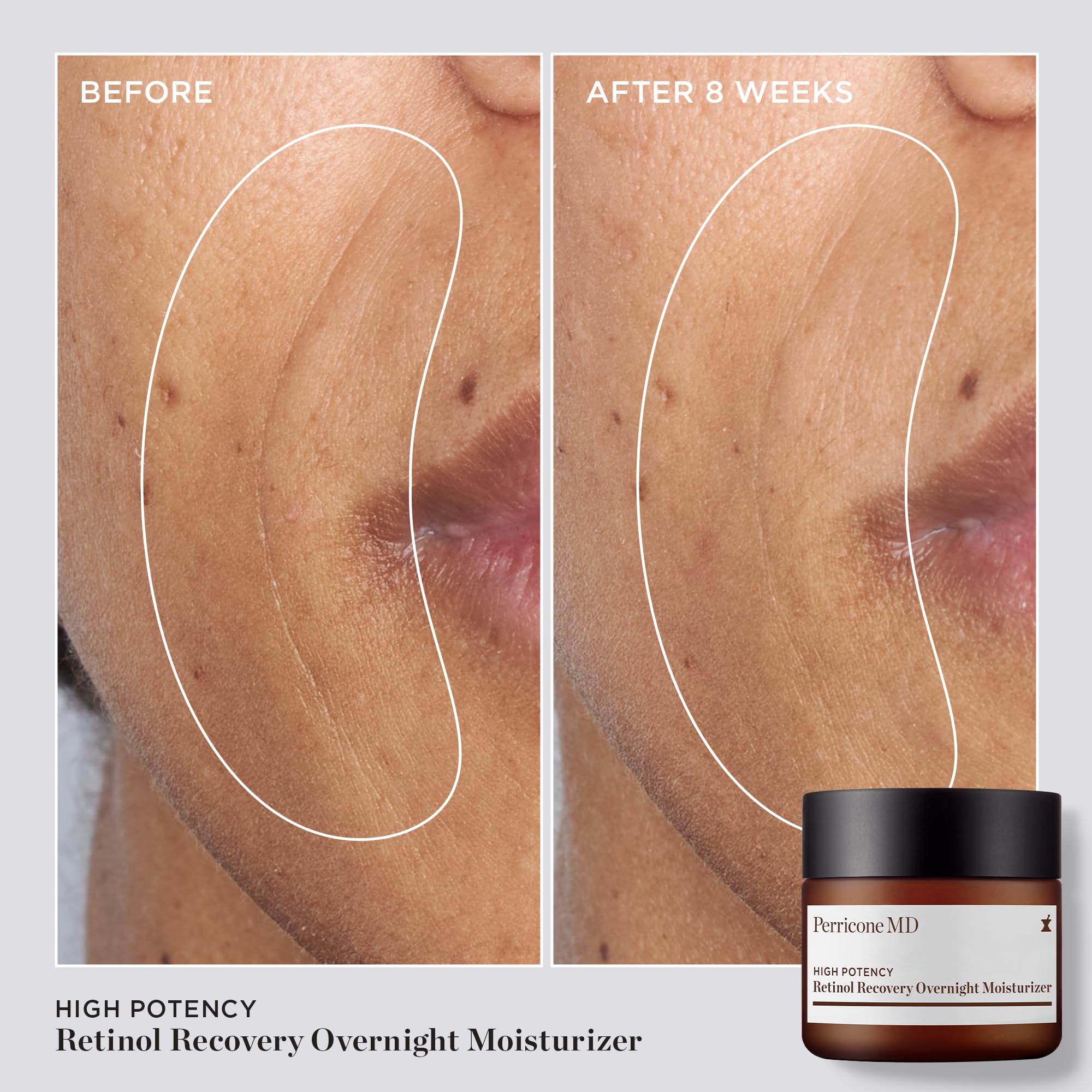 Perricone MD vegetable triglyceride complex hydration image emphasizing barrier protection and softness.