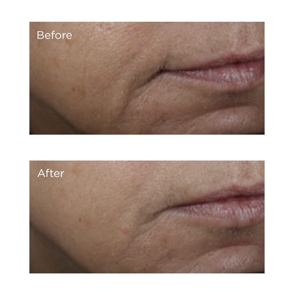 Perricone MD Vitamin C Ester even-tone close-up suggests balanced complexion.