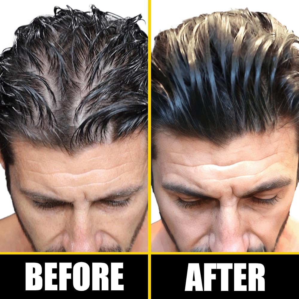 Pete & Pedro BOOST serum dropper closeup for precise application on targeted areas.
