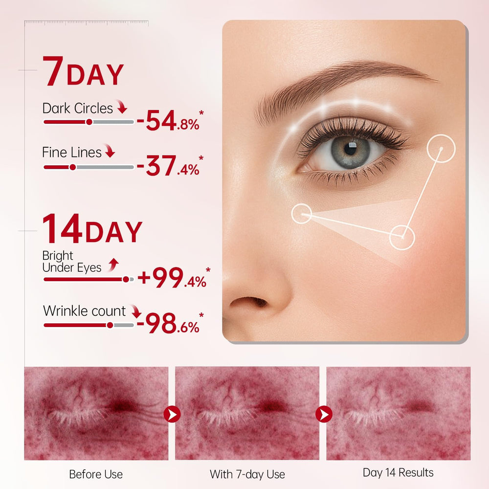 Peunitory eye balm application shows smooth glide for awake eyes.