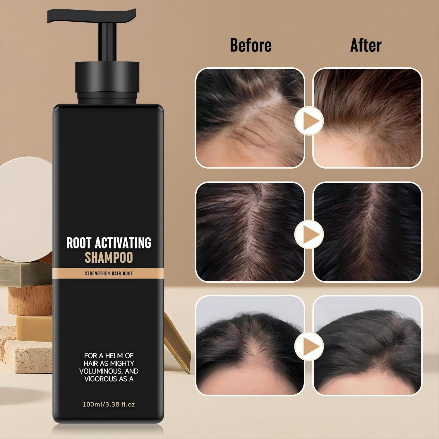 Pewatul Root Activator Shampoo natural ingredients highlight gentle, nourishing care.