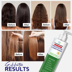 PHARMBANNER Folliculitis Conditioner smoothing formula texture aids detangling.