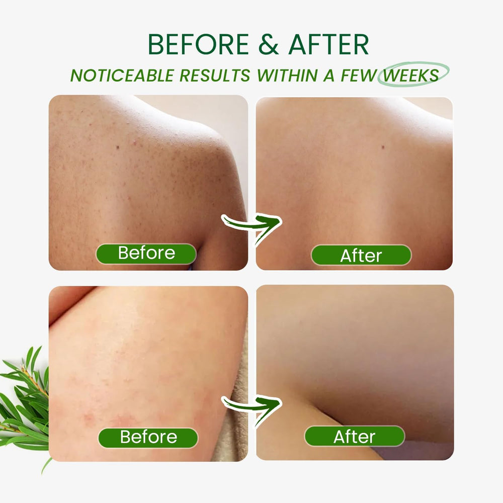 PHARMBANNER Tea Tree Body Wash ingredients page shows tea tree oil benefits.