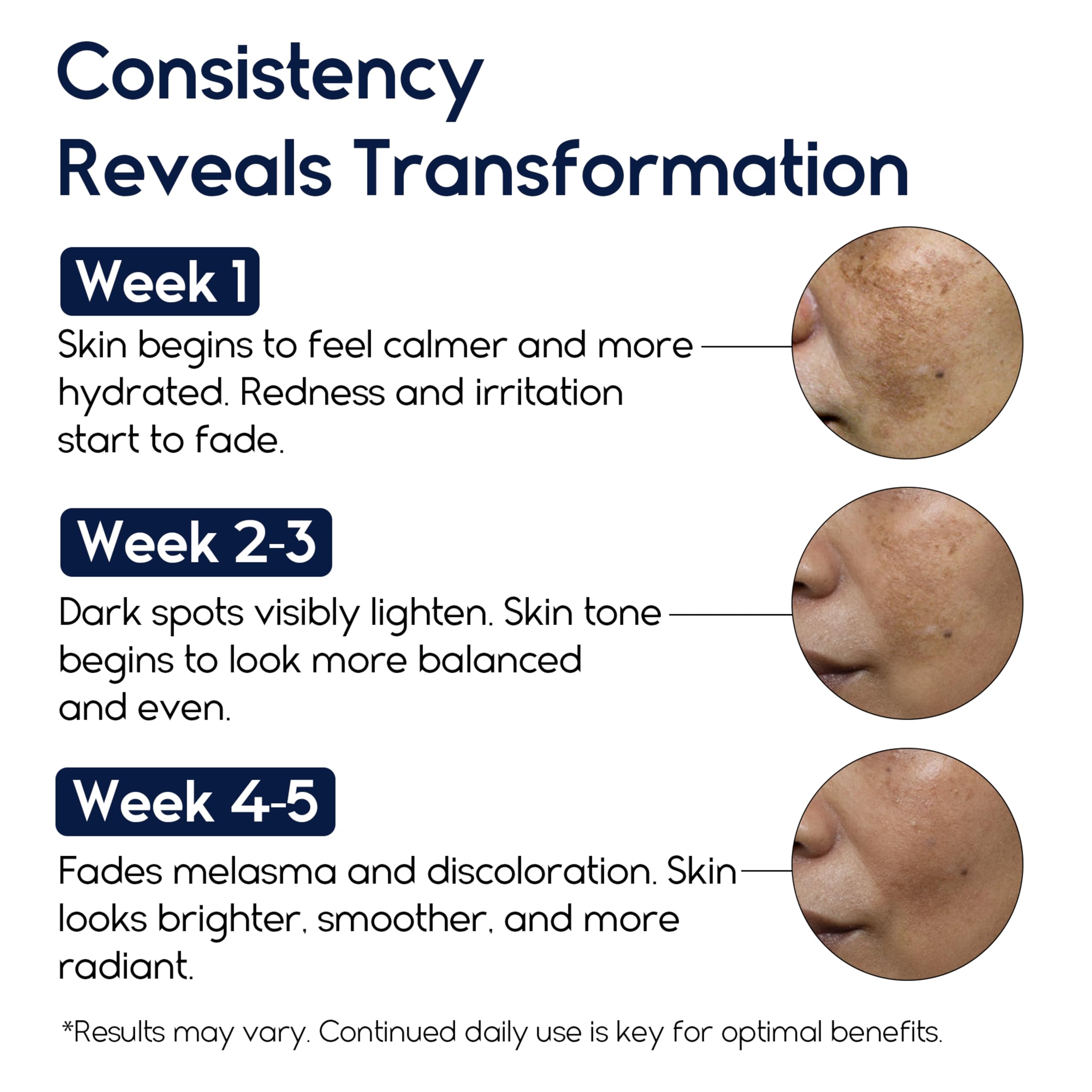 Pharmlitalia dark spot remover cream on hand demonstrates brightening action.
