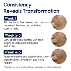 Pharmlitalia dark spot remover cream on hand demonstrates brightening action.
