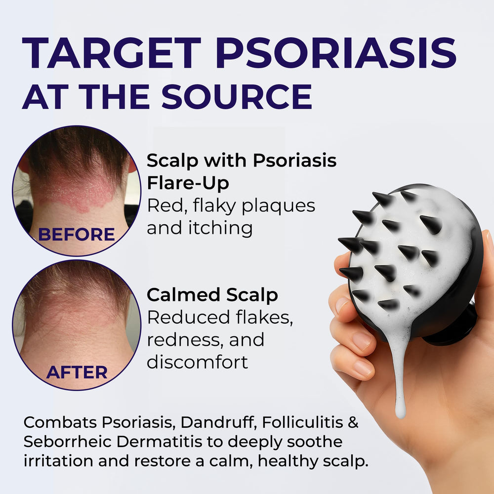Pharmlitalia Flakes Shampoo pour demonstrates soothing scalp care during wash.