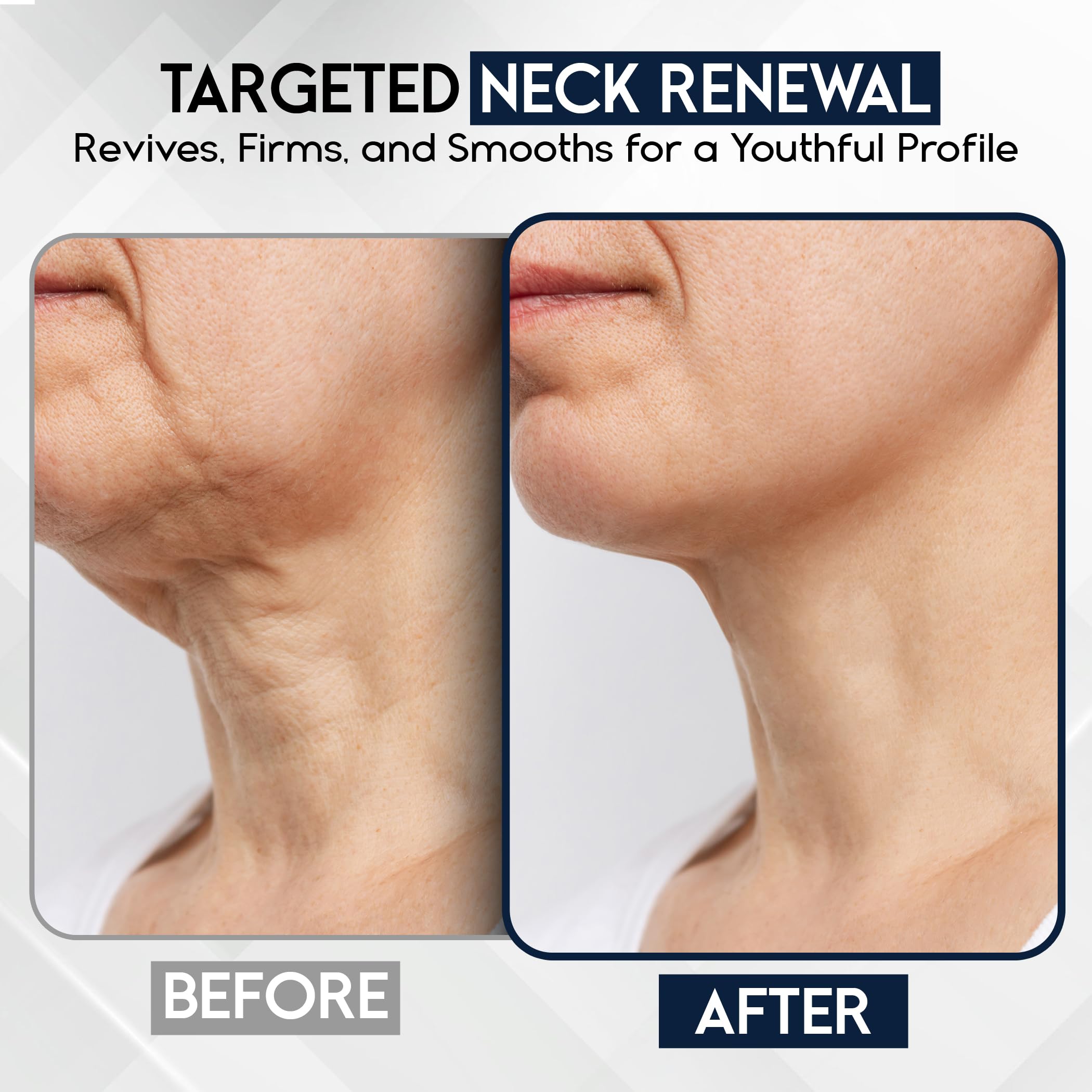 Pharmlitalia neck-tightening-cream application highlights lifting of the neck area