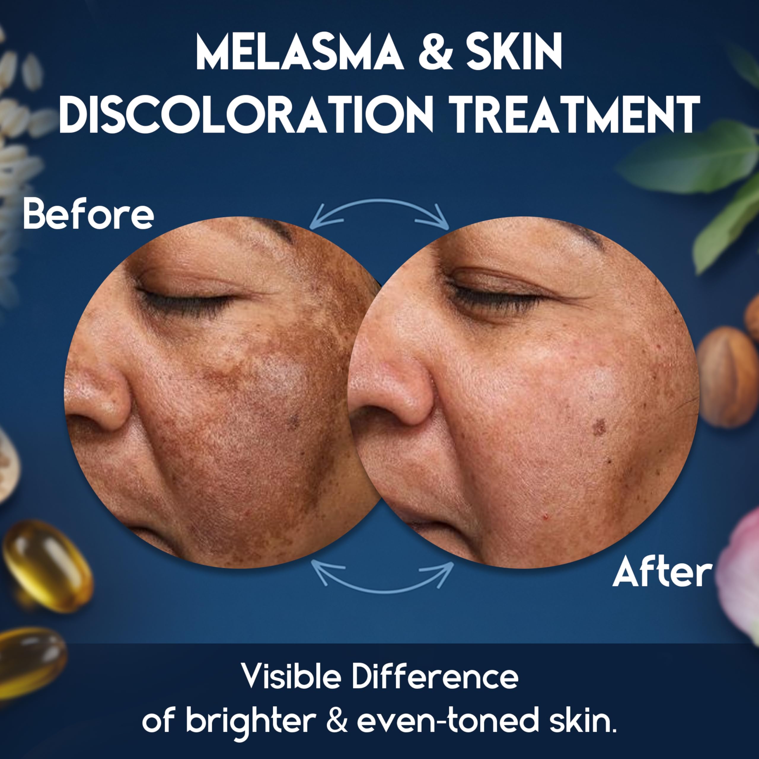 Pharmlitalia skin brightening cream tube highlights radiant complexion.
