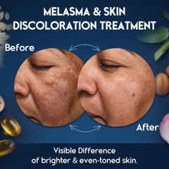 Pharmlitalia skin brightening cream tube highlights radiant complexion.