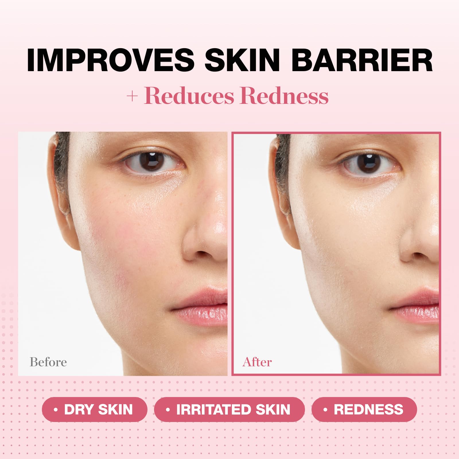 PHYSIOGEL redness-reducing cream packaging front highlights fragrance-free formula