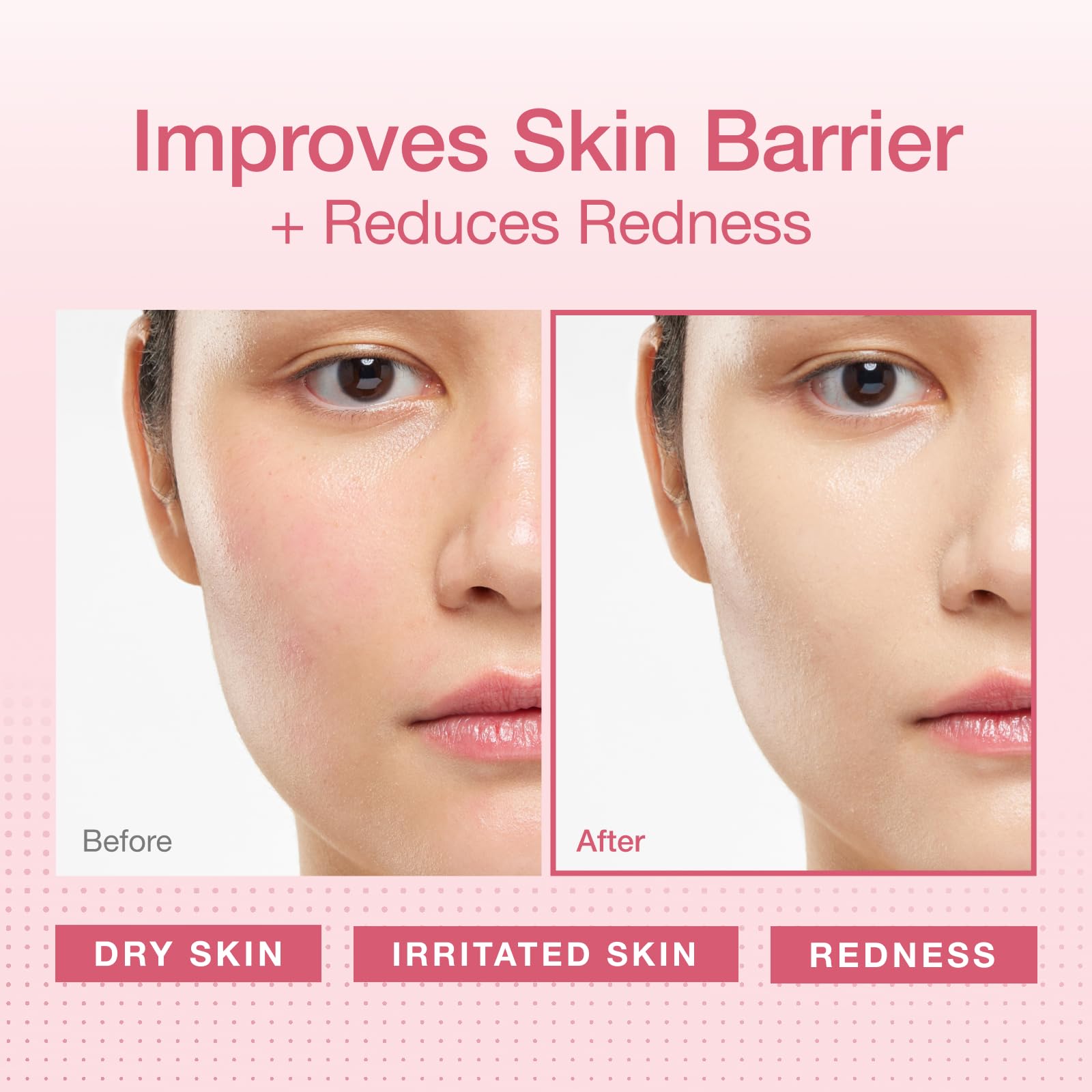 Physiogel redness-reducing-cream tube-application illustrating easy daily use for soothing dry skin