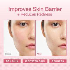 Physiogel redness-reducing-cream tube-application illustrating easy daily use for soothing dry skin