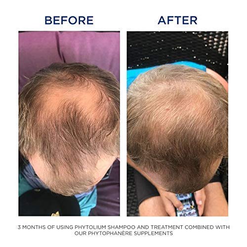 PHYTO Phytophanère capsule shot shows omega-3 and omega-6 nutrients for hair vitality.