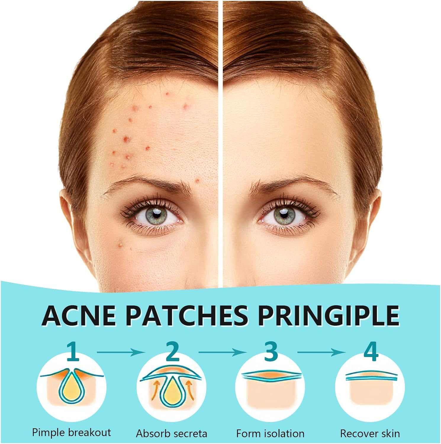 PICcircuit Pimple Patches invisible matte design blends with makeup.