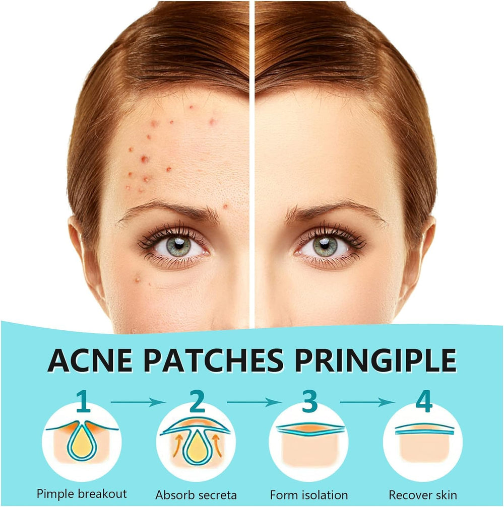 PICcircuit Pimple Patches invisible matte design blends with makeup.