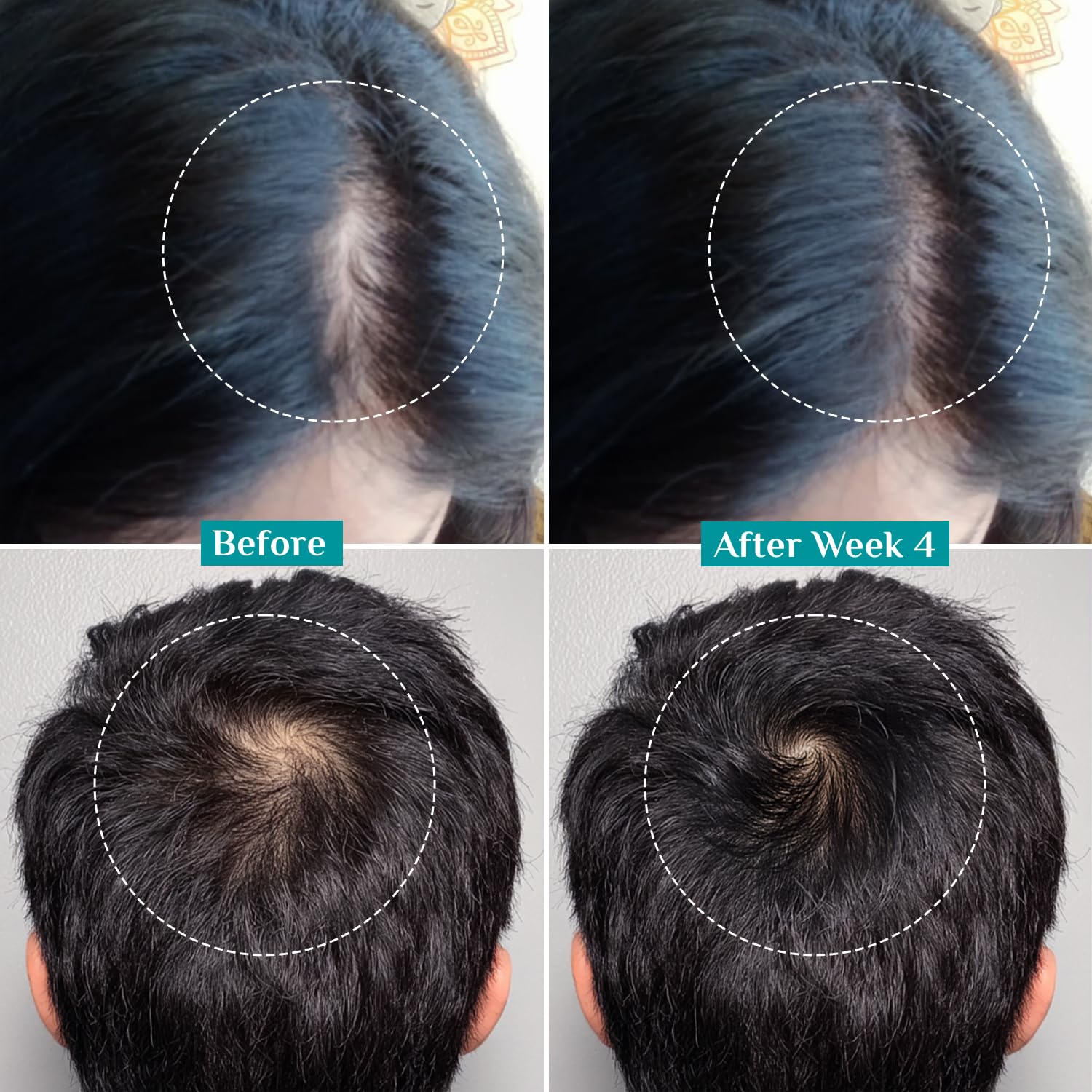 Pilgrim Hair Growth Serum quick-absorbing image ideal for a simple daily routine