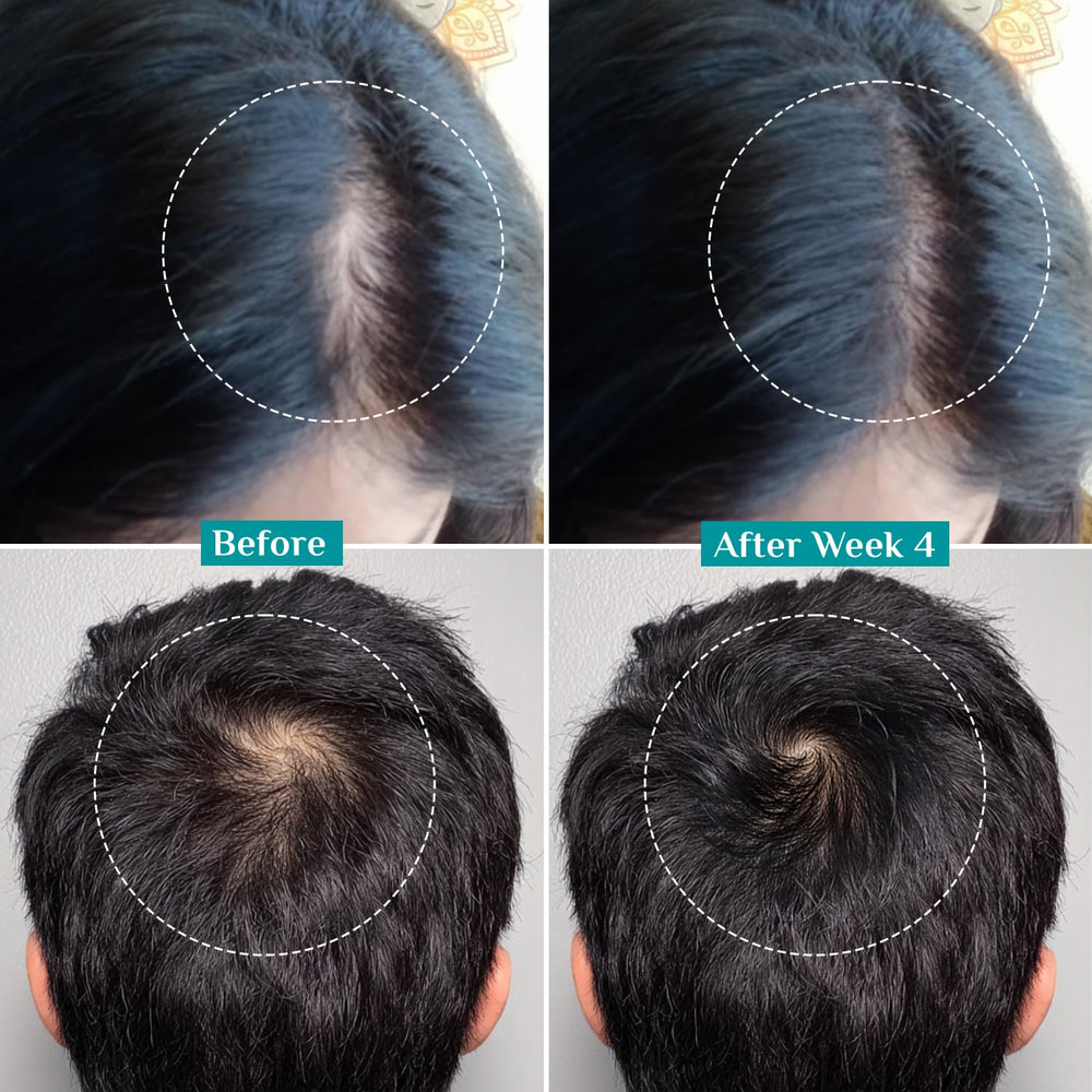 Pilgrim Hair Growth Serum quick-absorbing image ideal for a simple daily routine
