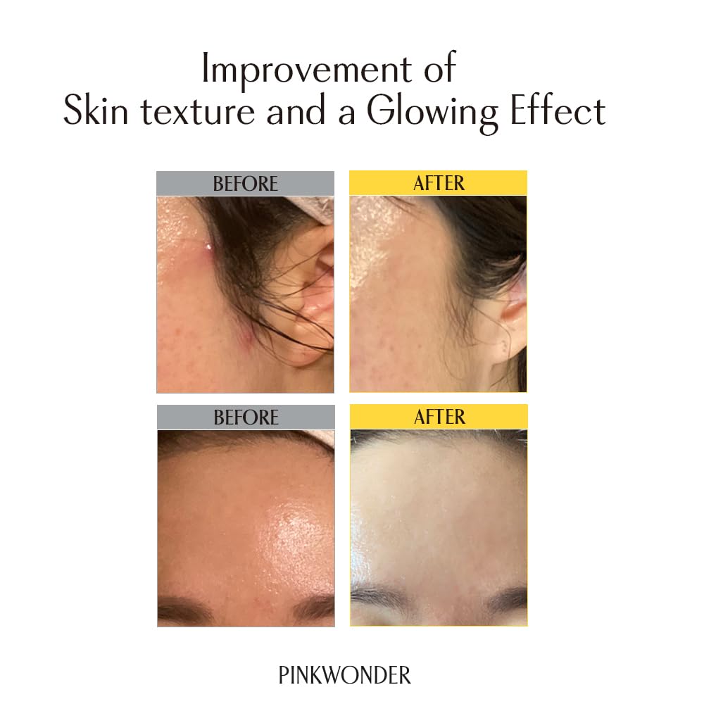 PINKWONDER Jojoba Oil on the face delivering non-greasy hydration.