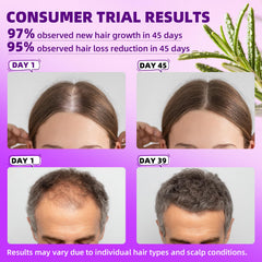 Pipuxi minoxidil spray application for easy daily scalp nourishment