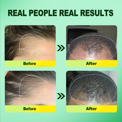 Pipuxi minoxidil rosemary formula label highlights rosemary-infused scalp nourishment