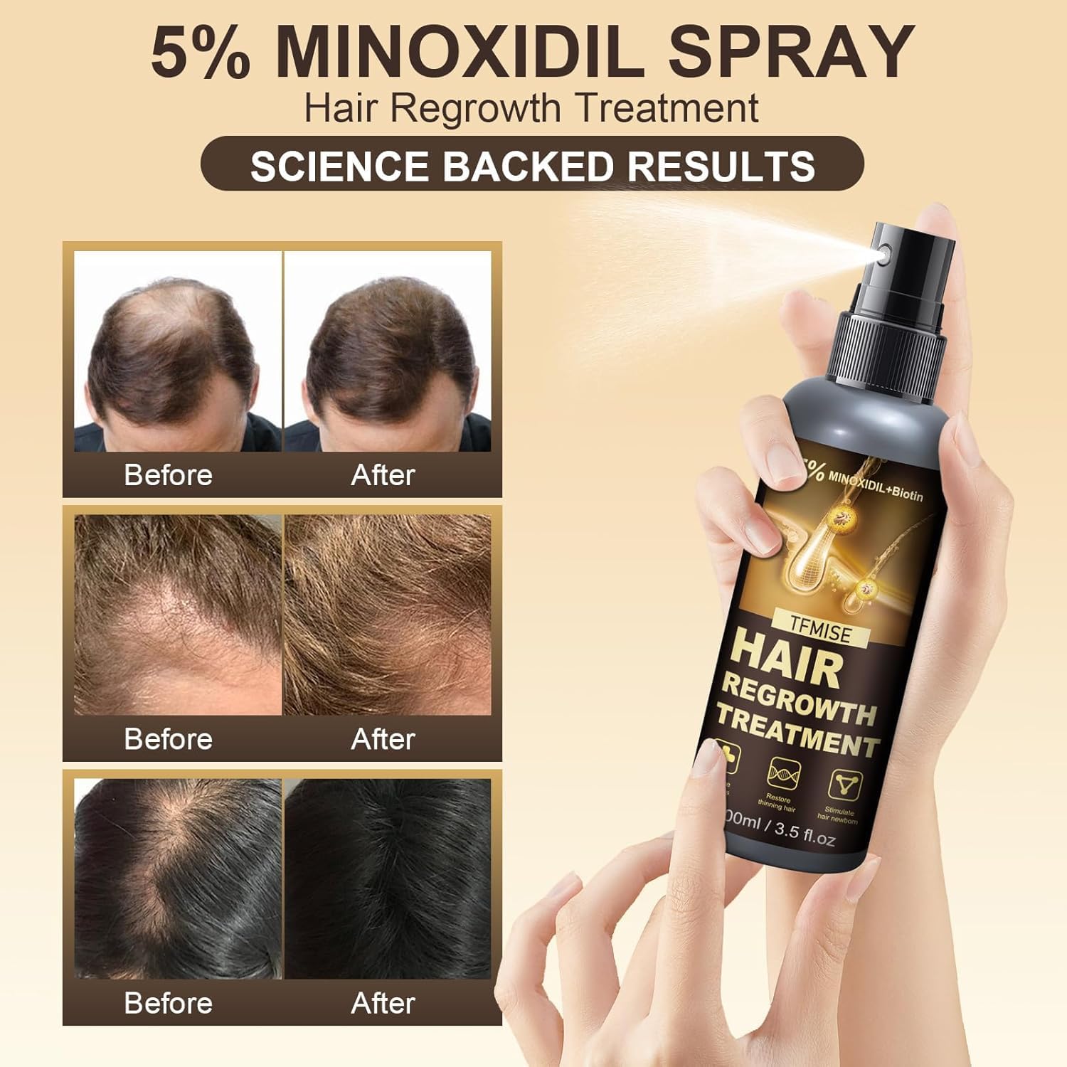 Pipuxi Minoxidil Spray being applied to scalp for even coverage.