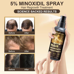 Pipuxi Minoxidil Spray being applied to scalp for even coverage.