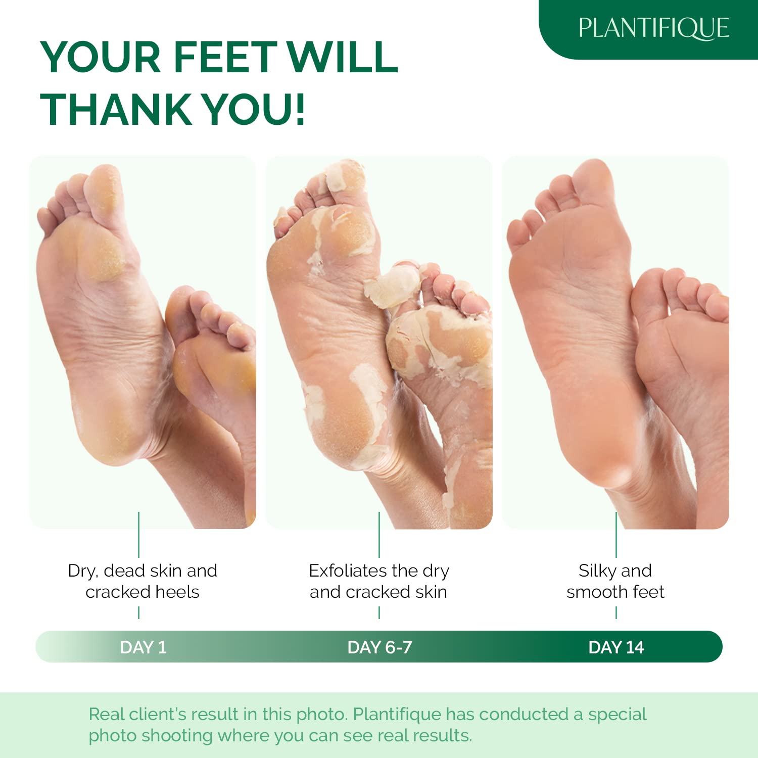 PLANTIFIQUE Foot Peel Mask applying-action shows painless exfoliation.