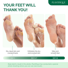 PLANTIFIQUE Foot Peel Mask applying-action shows painless exfoliation.