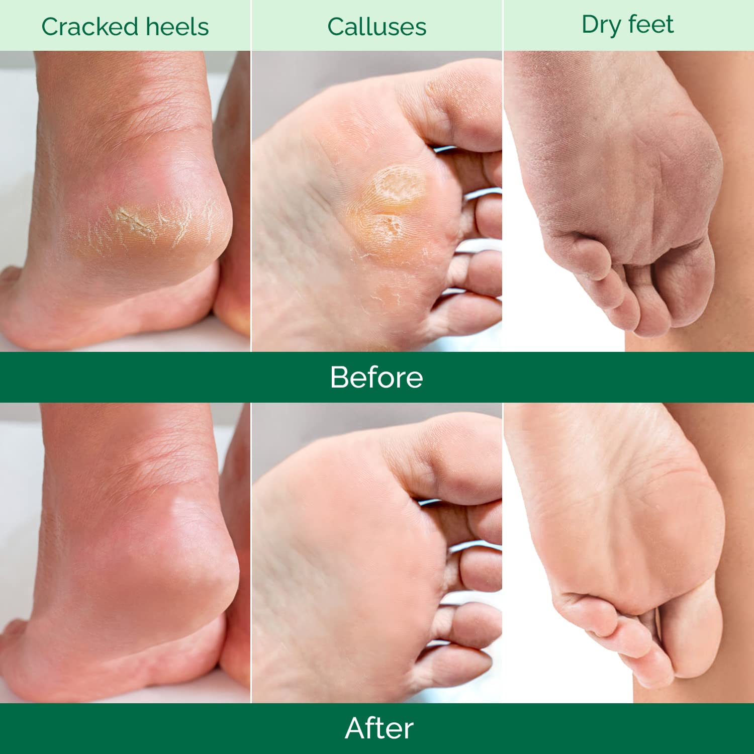 PLANTIFIQUE Foot Peel Mask soak-before-use illustrates prep step.