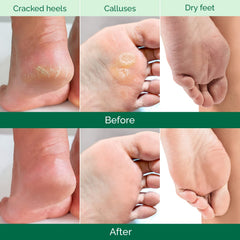 PLANTIFIQUE Foot Peel Mask soak-before-use illustrates prep step.
