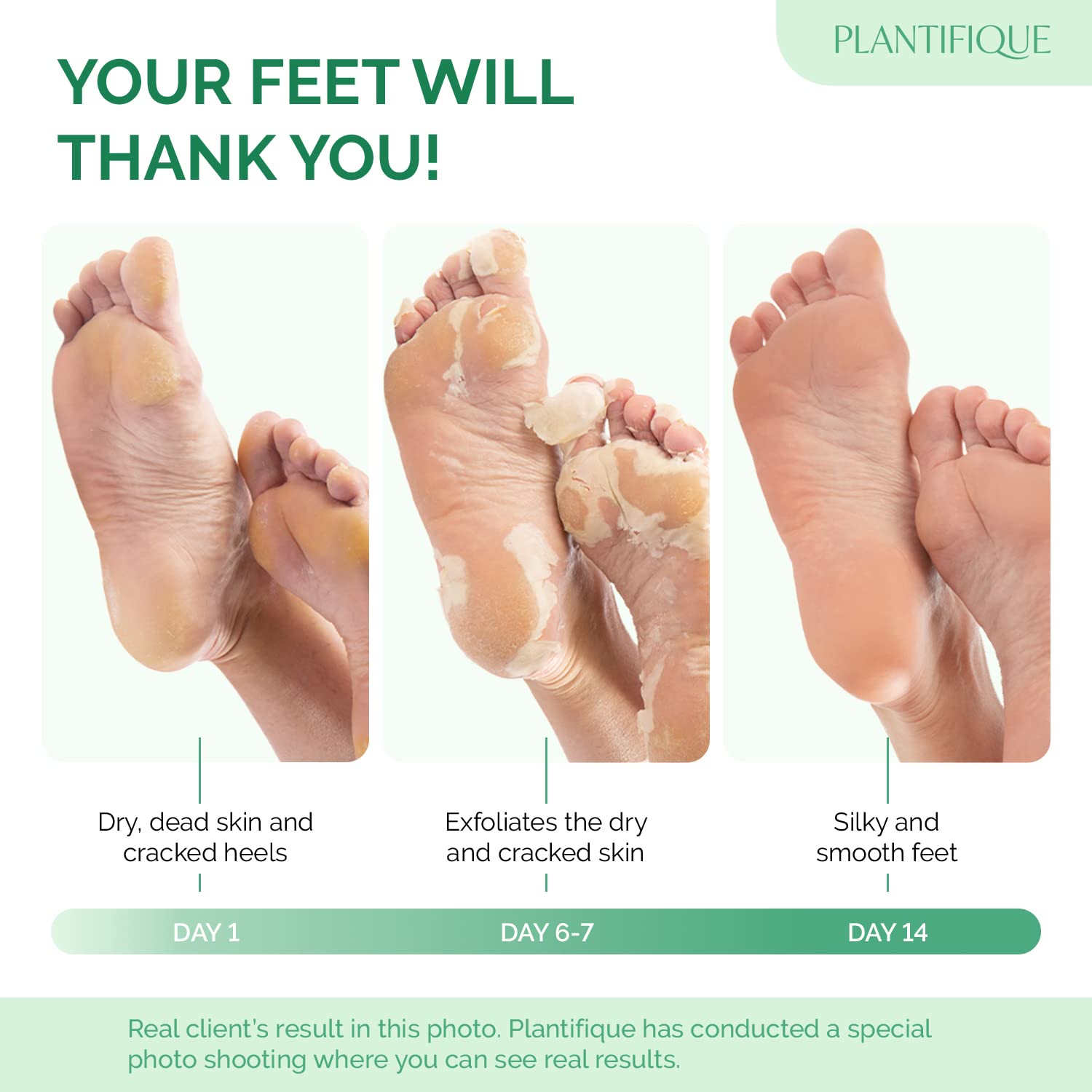 PLANTIFIQUE Foot Peeling Mask 2 Pack packaging box highlights dermatologist-tested formula for safety.
