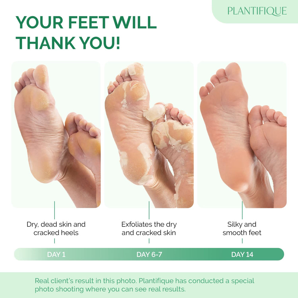 PLANTIFIQUE Foot Peeling Mask 2 Pack packaging box highlights dermatologist-tested formula for safety.