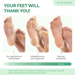 PLANTIFIQUE Foot Peeling Mask 2 Pack packaging box highlights dermatologist-tested formula for safety.