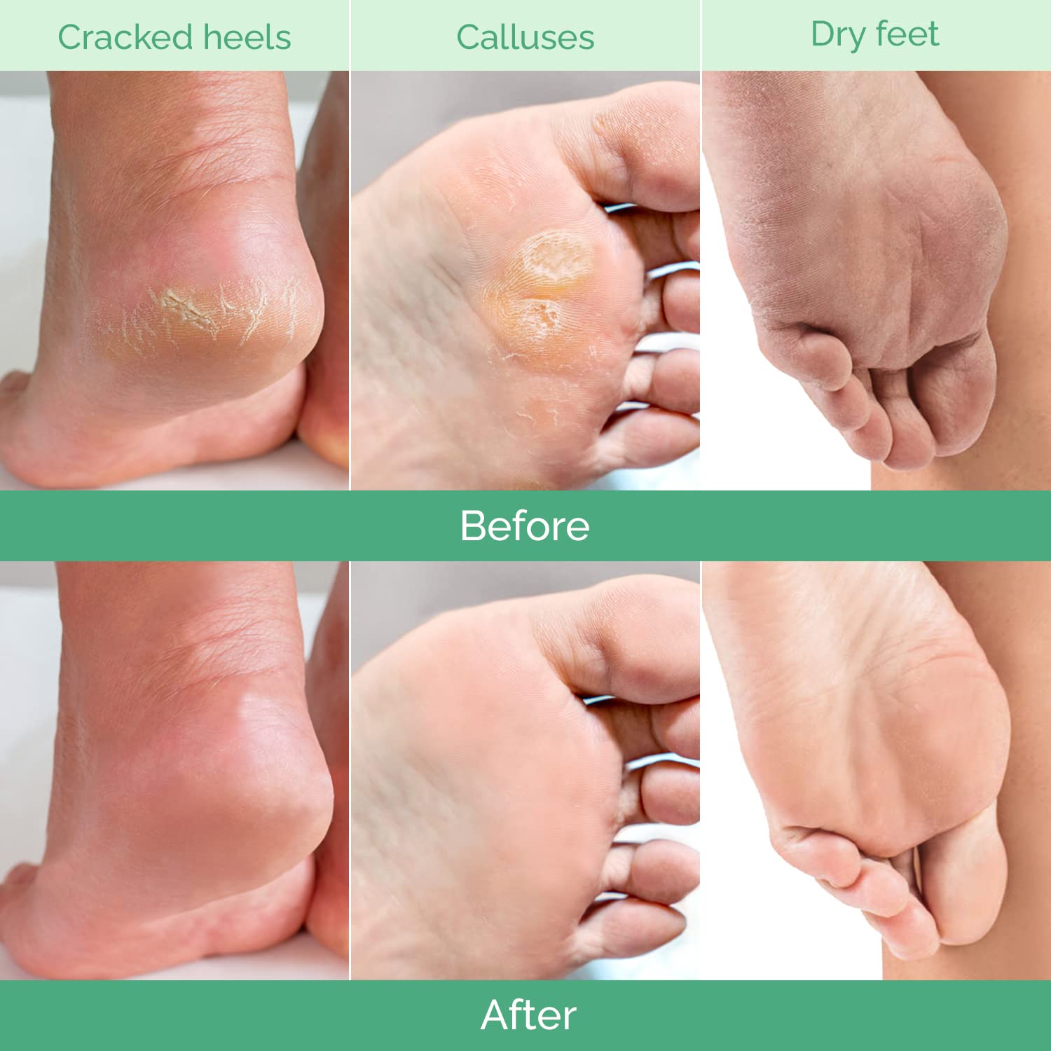 PLANTIFIQUE Foot Peeling Mask 2 Pack soak-step demonstrates at-home exfoliation process.