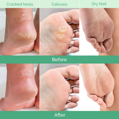 PLANTIFIQUE Foot Peeling Mask 2 Pack soak-step demonstrates at-home exfoliation process.