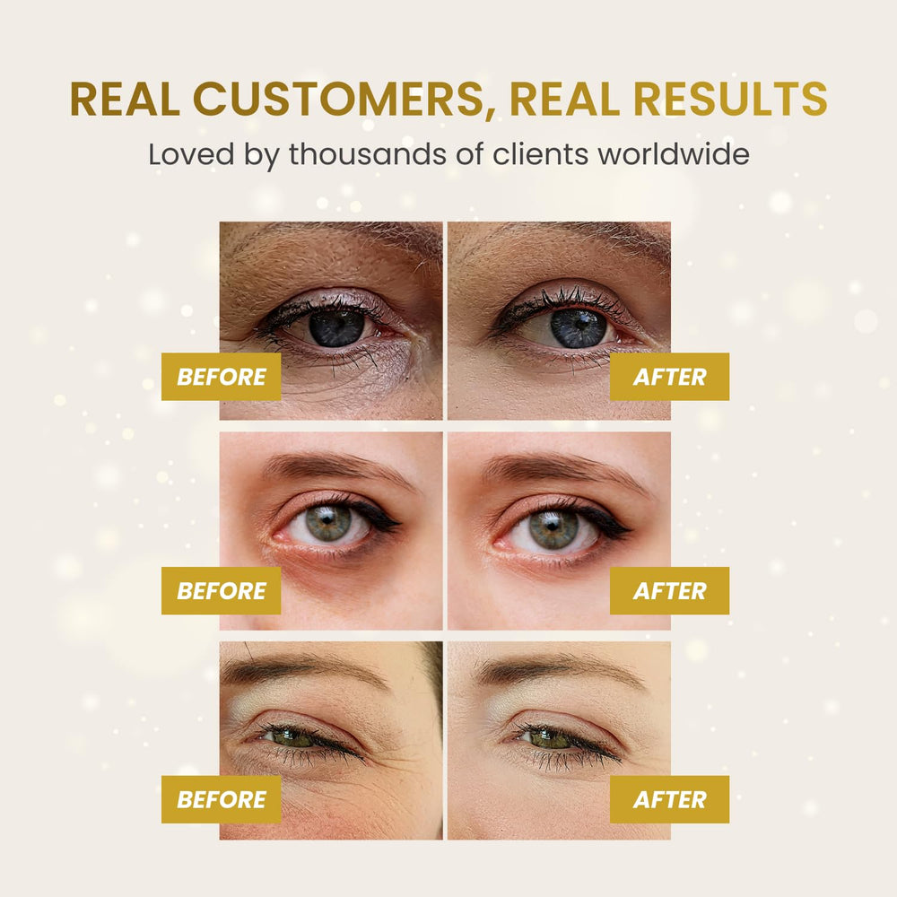 PLANTIFIQUE Gold Eye Patches hyaluronic acid close-up emphasizing hydration