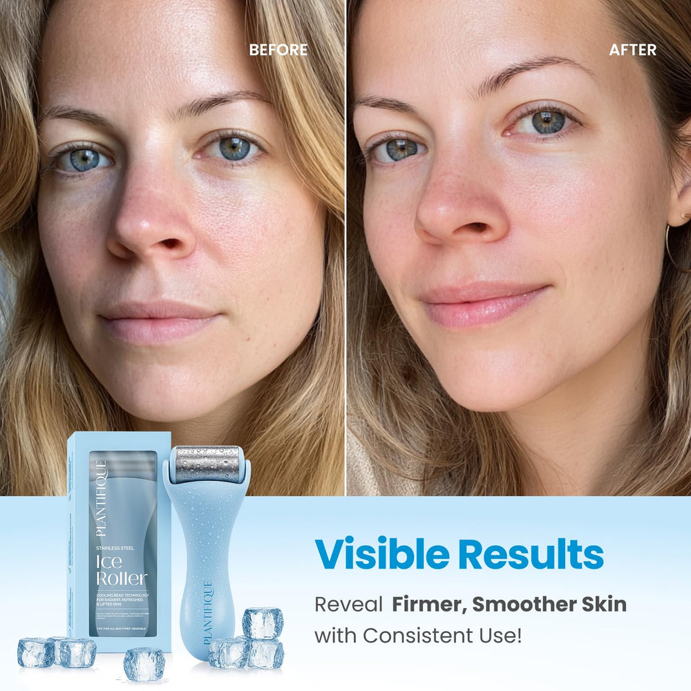 Plantifique ice roller on the face highlighting puffiness relief