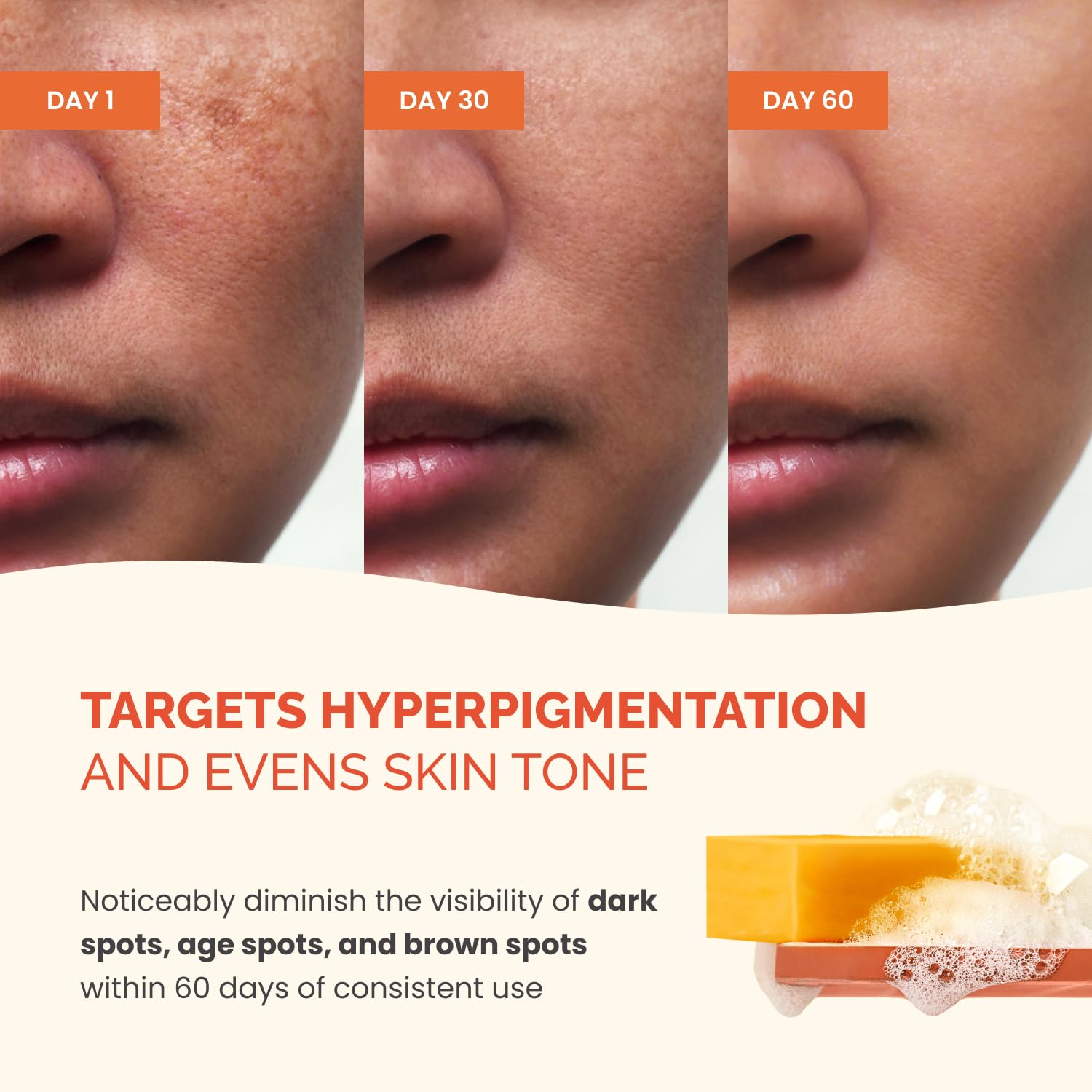 PLANTIFIQUE Kojic Acid Soap targets dark spots for a more even tone.