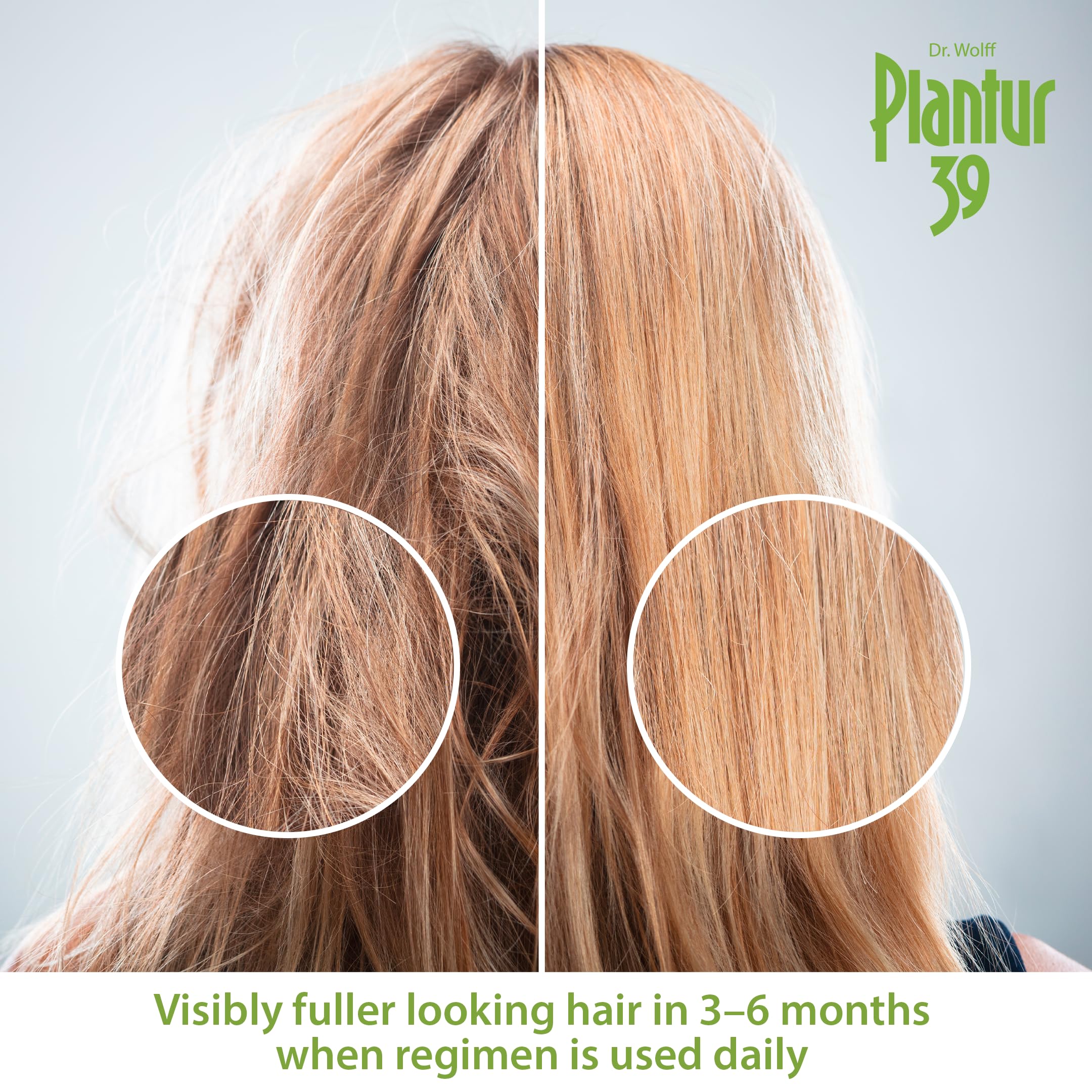 Plantur 39 over-40 targeted formula supports menopausal thinning hair.