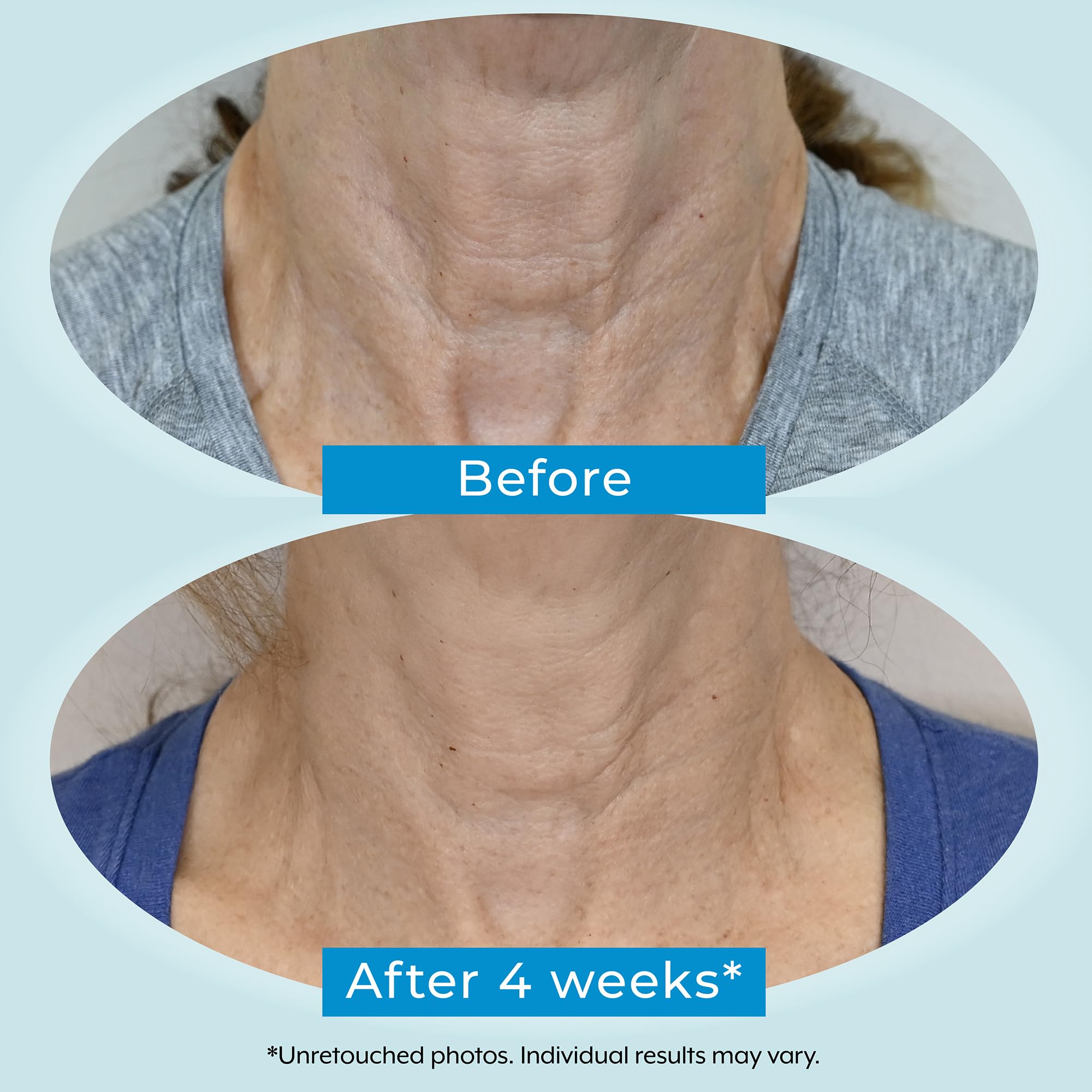Plexaderm ingredient panel highlights retinol and bakuchiol blend.