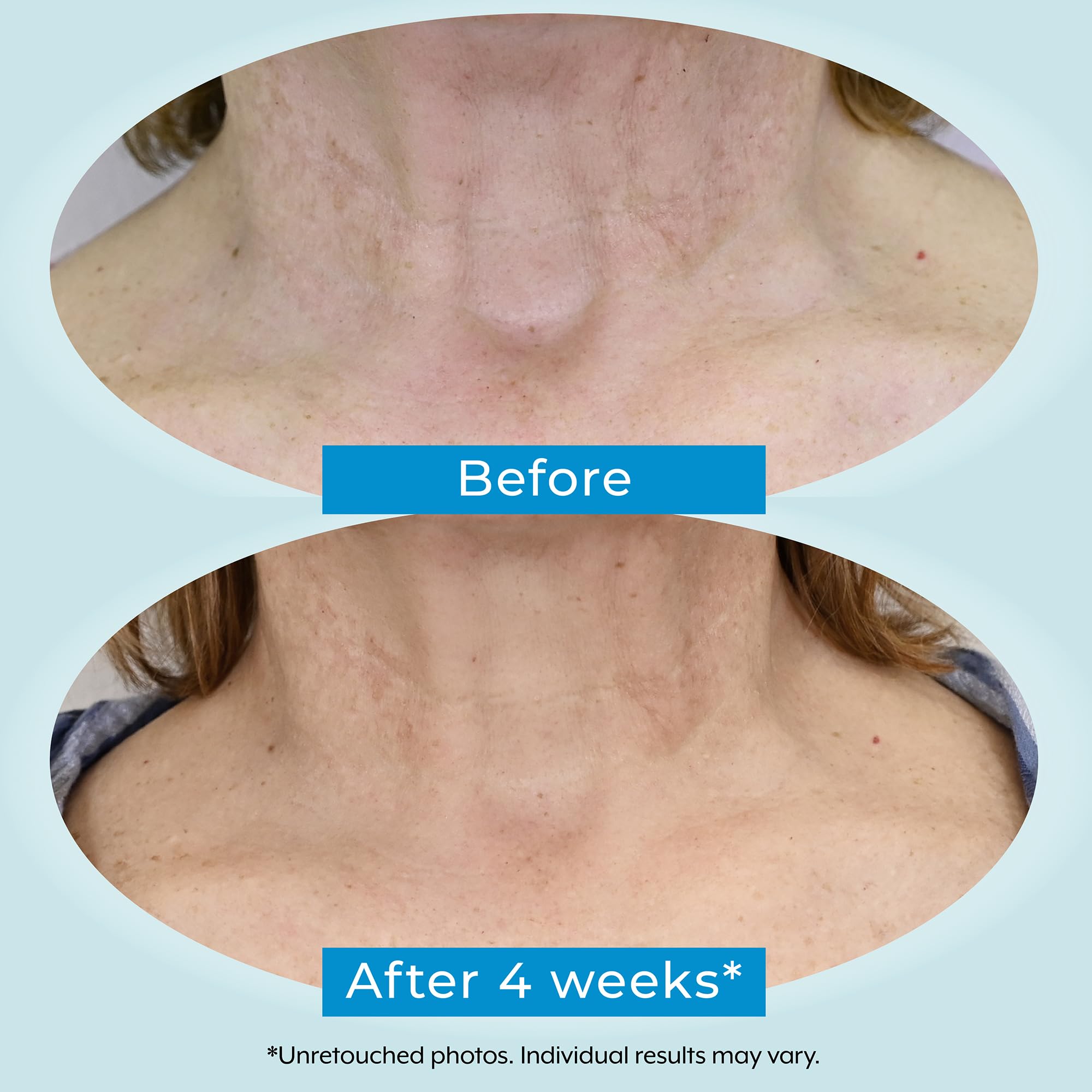 Plexaderm texture swatch reveals lightweight formula for easy absorption.